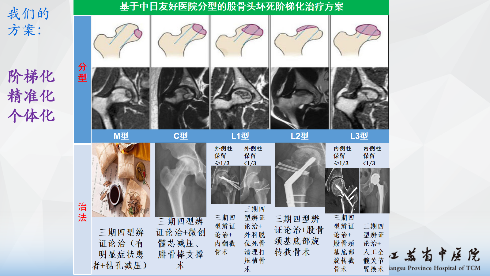 股骨头坏死一二三四期图片