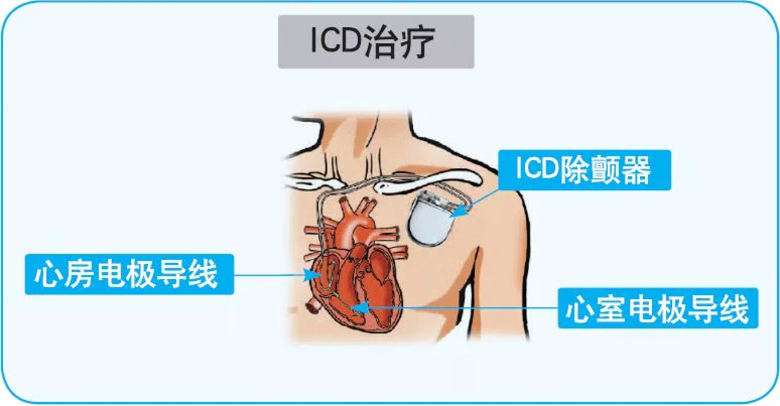这两大高科技不保持距离可能是要命的