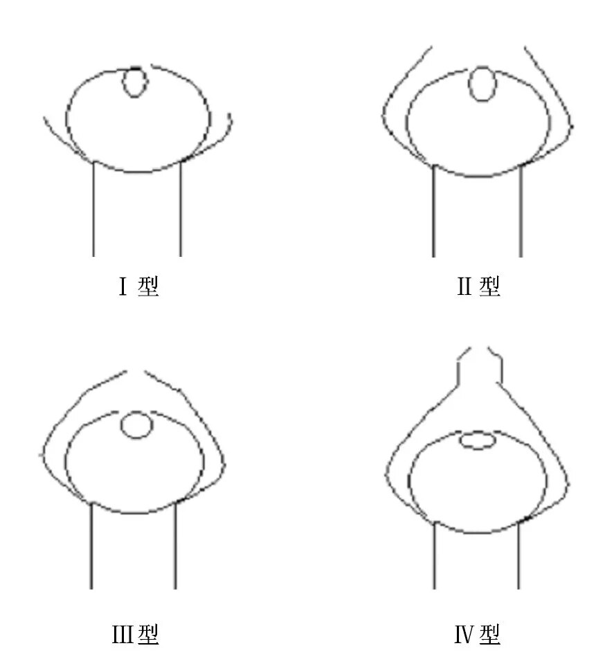 包皮整形术安全共识