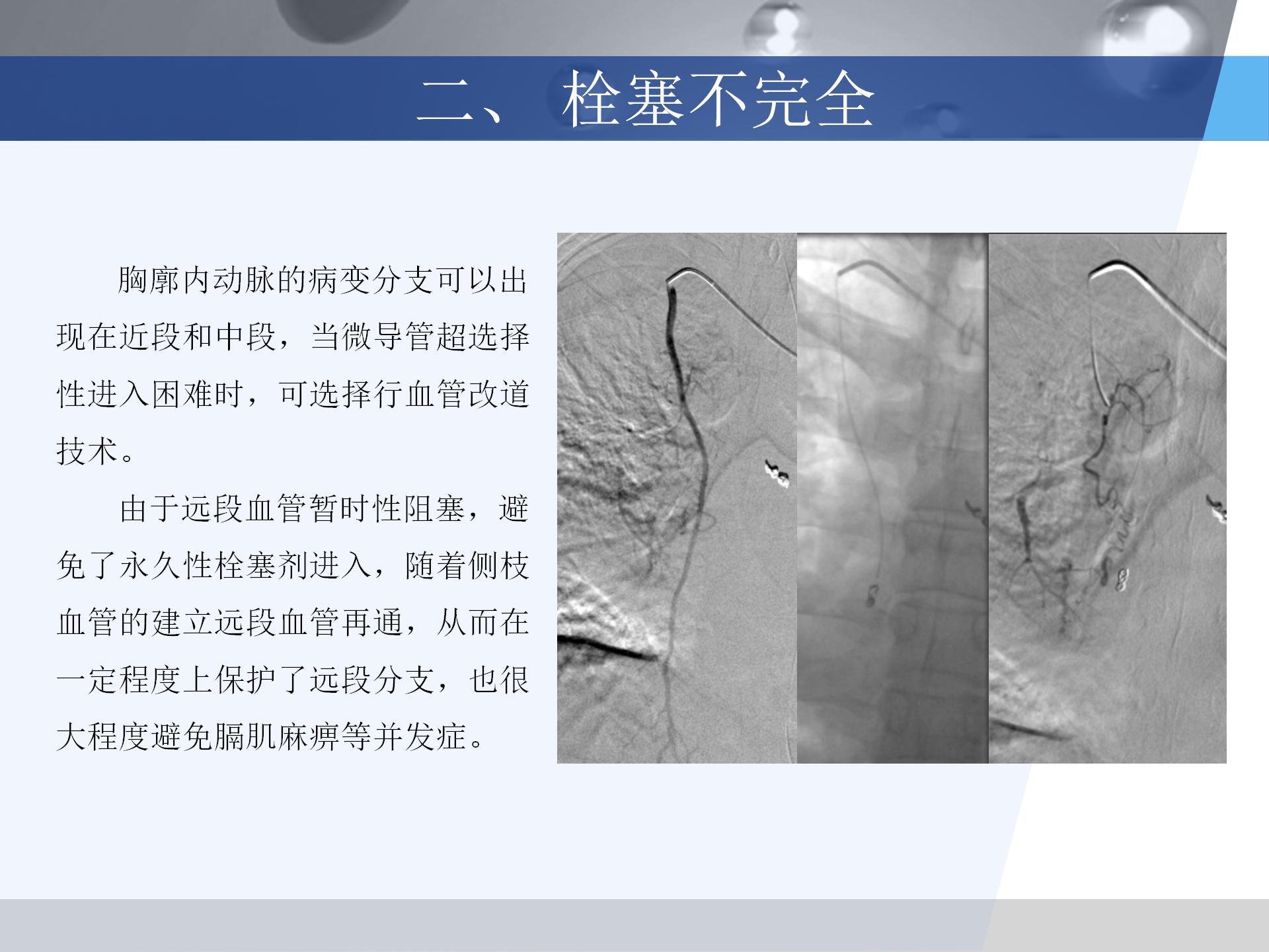 广医附一院-咯血病例汇报 [自动保存的]_18.jpg