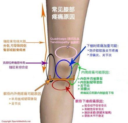 膝关节疼痛有哪些原因