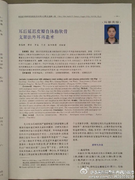 关于先天性小耳畸形耳再造的常见问题