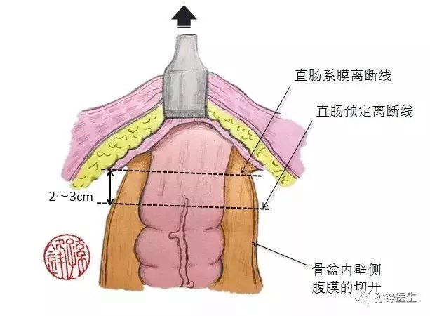暂无