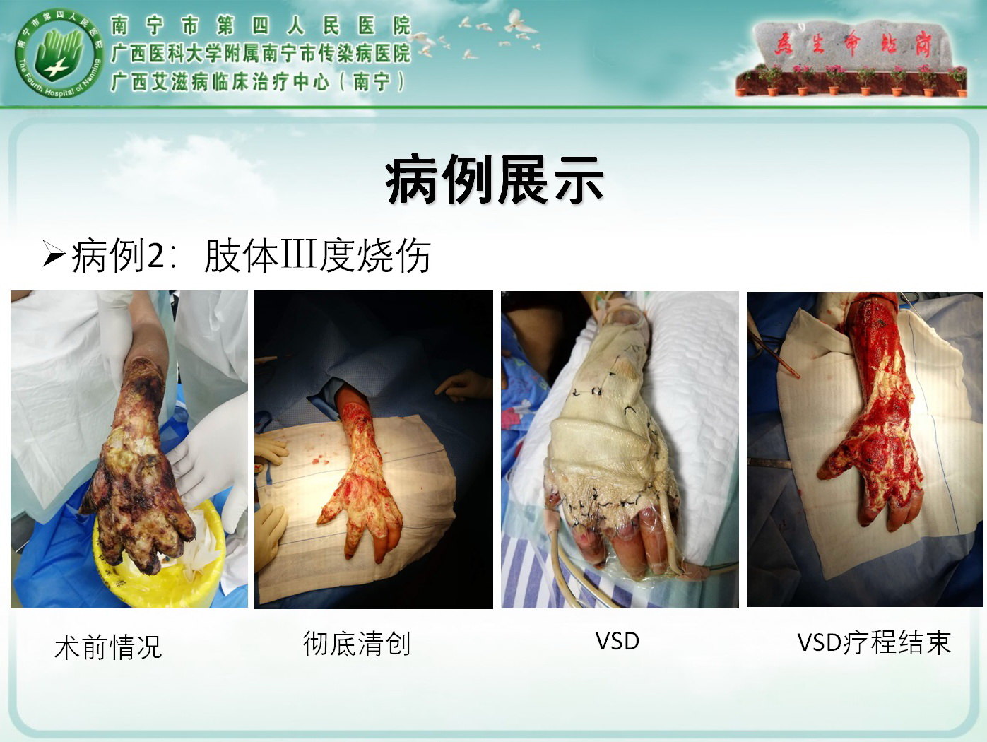 暂无