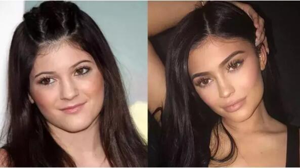 从一直不起眼的邻家小妹蜕变成时尚达人,这对靠"嘴"吃饭的kylie来说