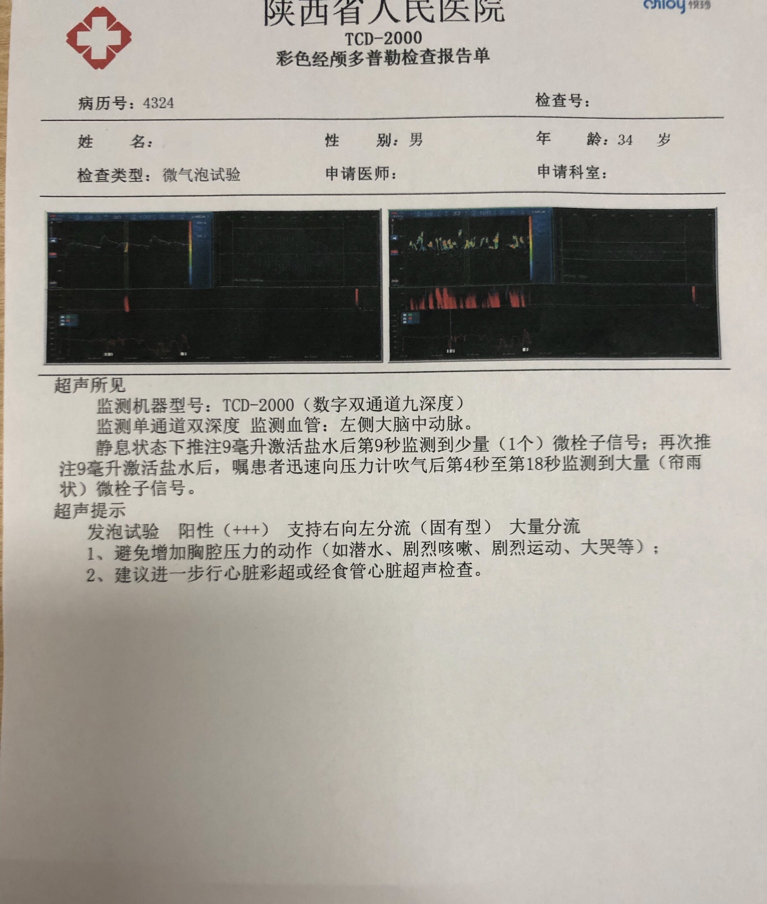 这是进一步的经食道心脏超声最终确认卵圆孔未闭,并对大小进行了测量.
