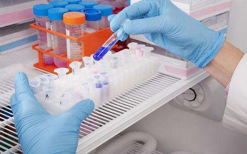 出现黄色精液是怎么回事 附睾炎 附睾炎