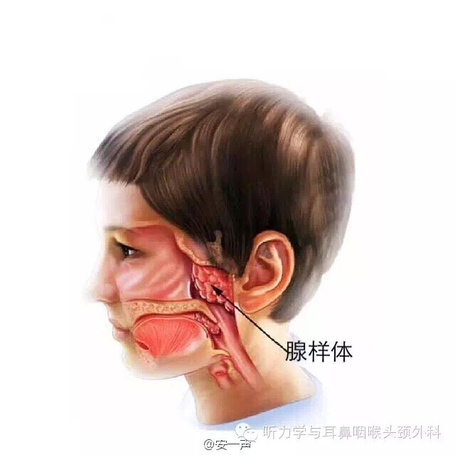 小儿腺样体疾病及手术适应症