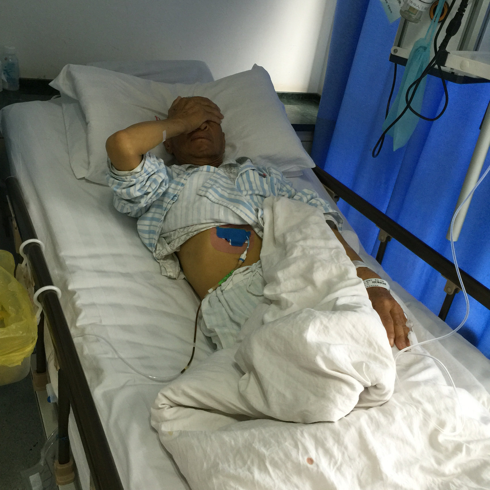 胆管梗阻黄疸肿瘤晚期放不了ercp支架怎么办? - 好大夫在线