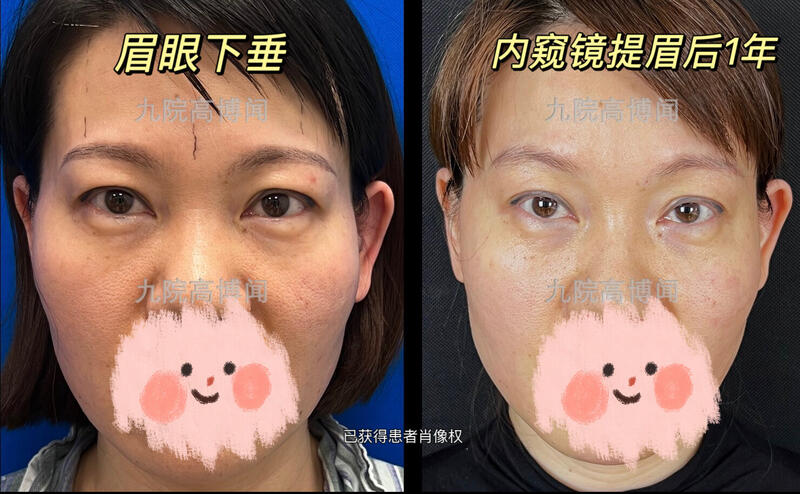 圖文圖片