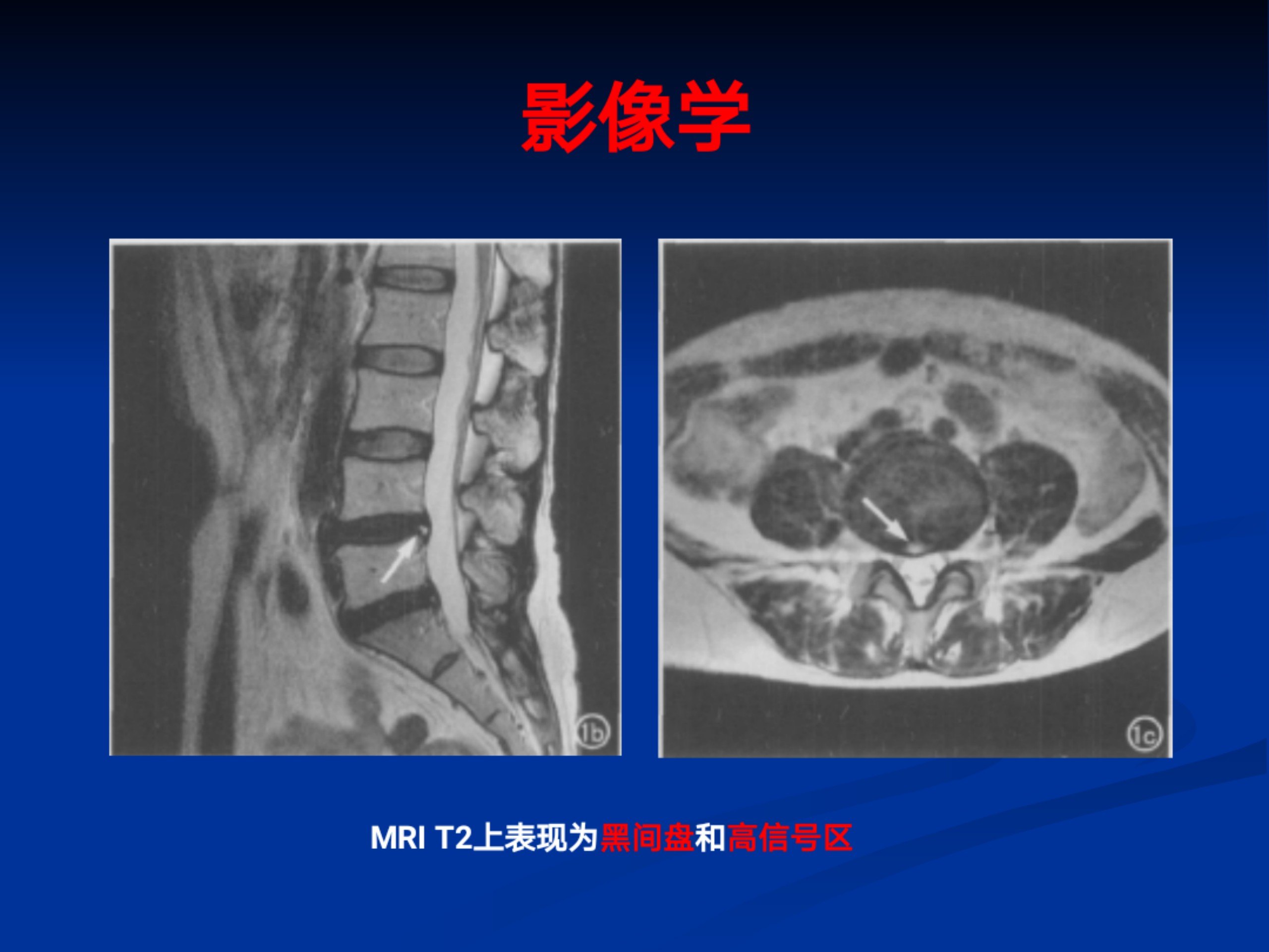 浅谈腰痛(1)_23.jpg