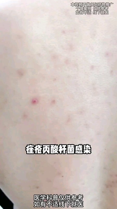 視頻封面