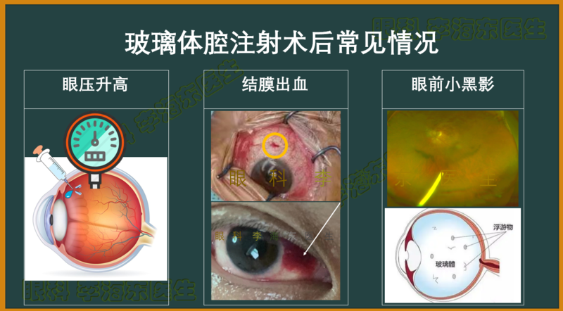 图3 注射后可能情况.png