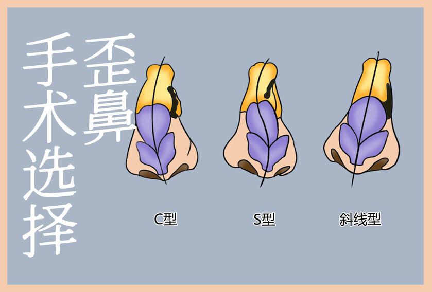 圖文圖片
