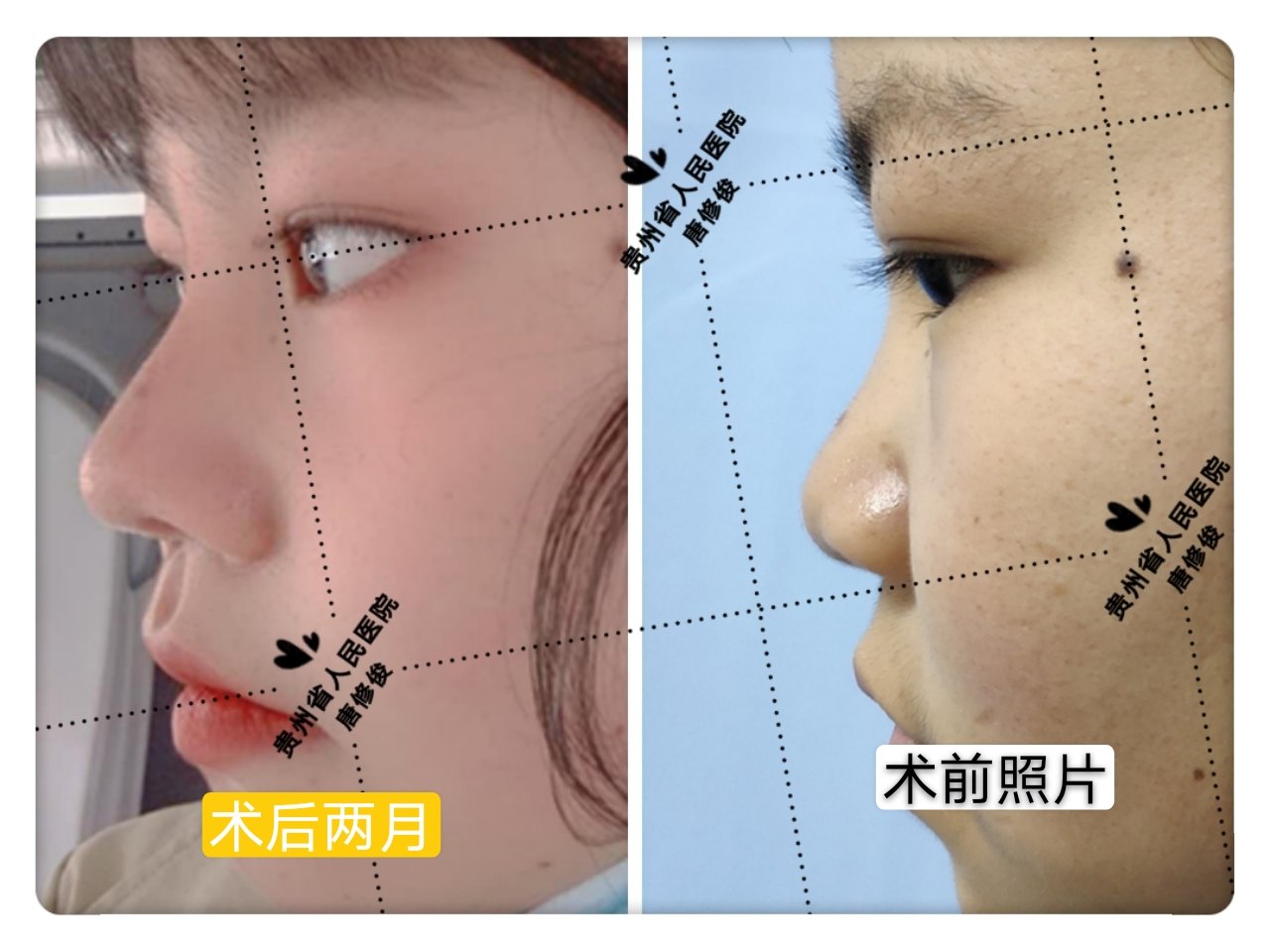 暂无