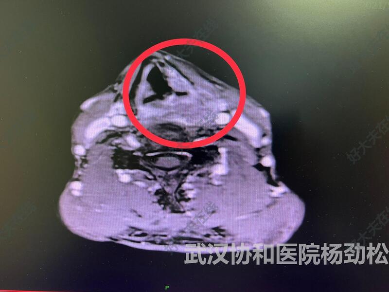 圖文圖片