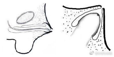 "小小鸟"也能飞得高_男性生殖器畸形_介绍_治疗方式 - 好大夫在线