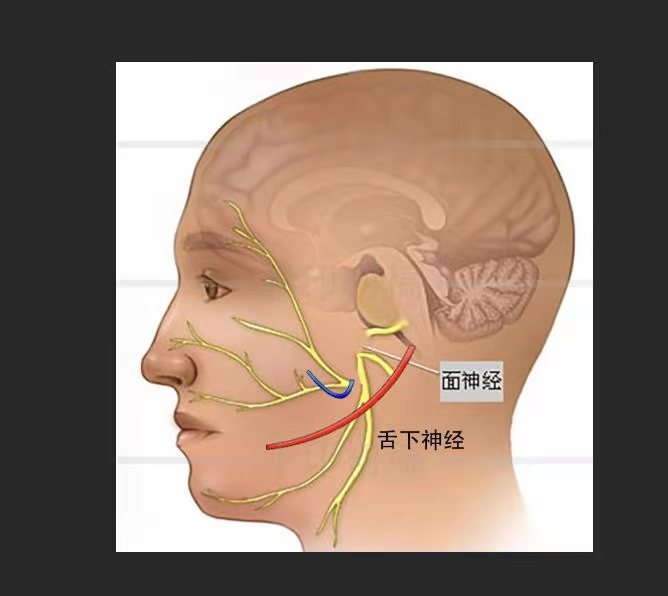 面神經顳支頬支—咬肌神經 健側下唇筋膜懸吊術3面神經咬肌神經吻合