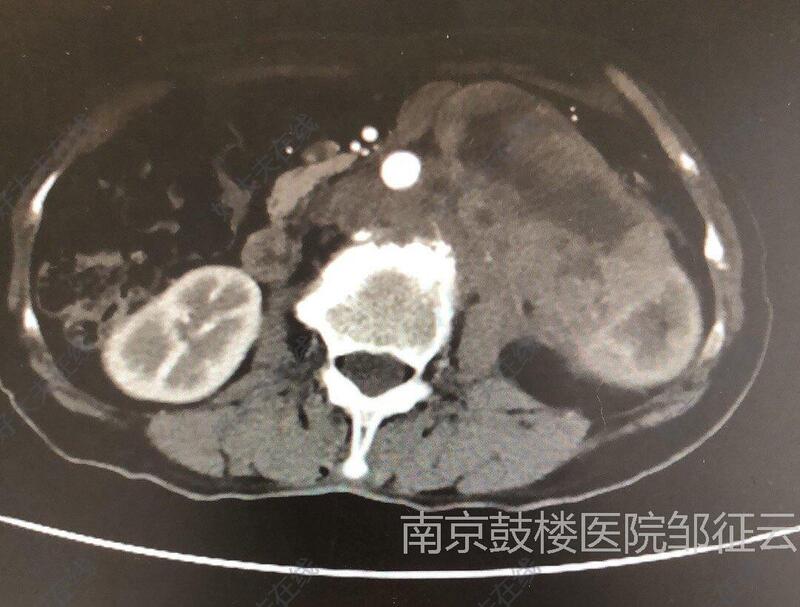 圖文圖片