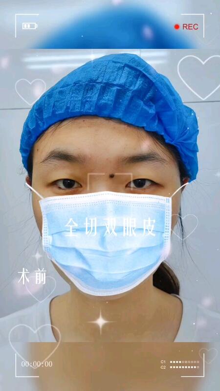 視頻封面