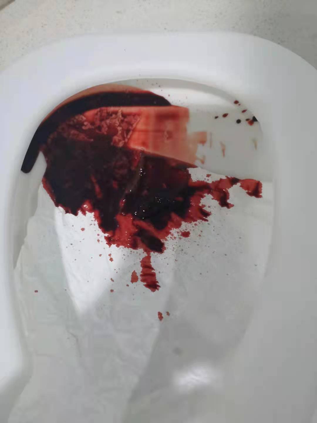 卫生间大出血图片图片