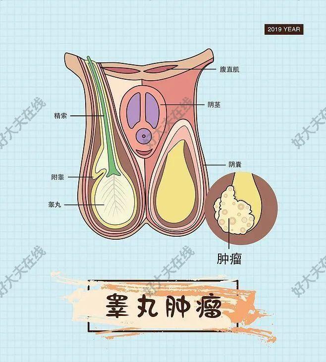 附睾头大小图片