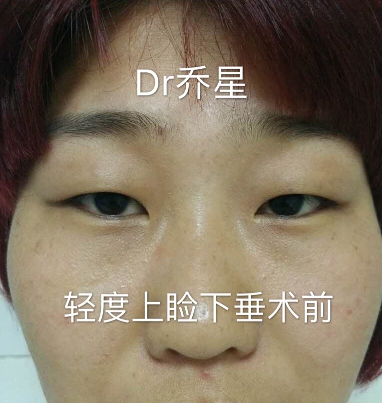 暂无