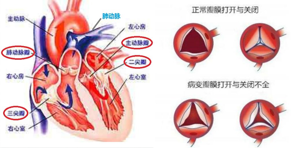 心脏瓣膜位置解剖图图片