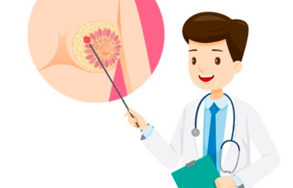 良性乳腺结节为何要手术?