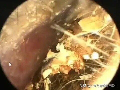 圖文圖片