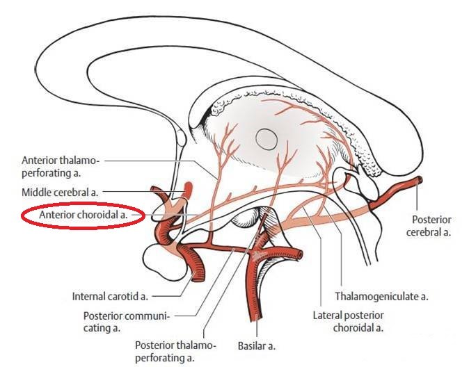 脉络膜前动脉(acha)解剖及其动脉瘤