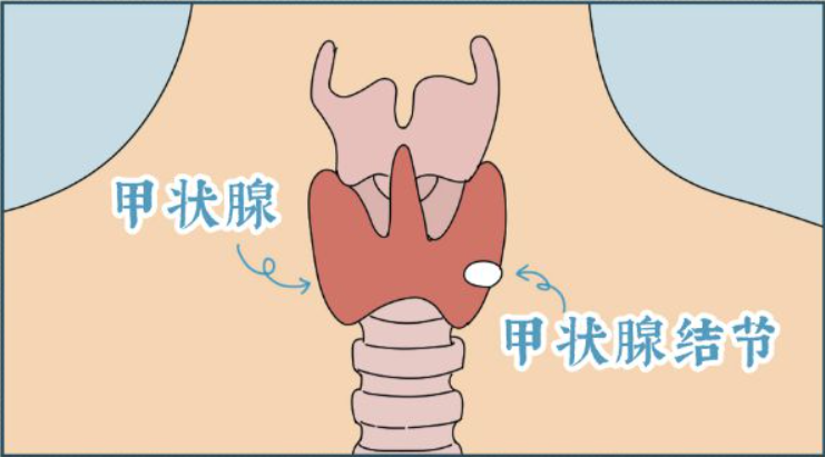 圖文圖片