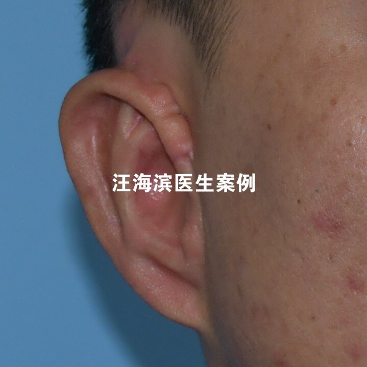 圖文圖片