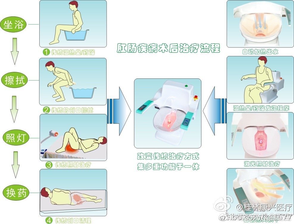 漫談肛腸科中醫特色的燻洗療法