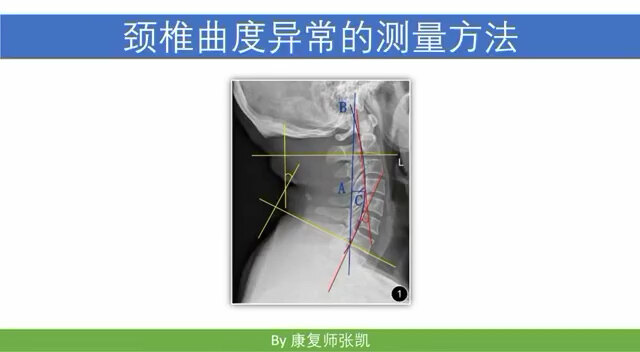 默认图片