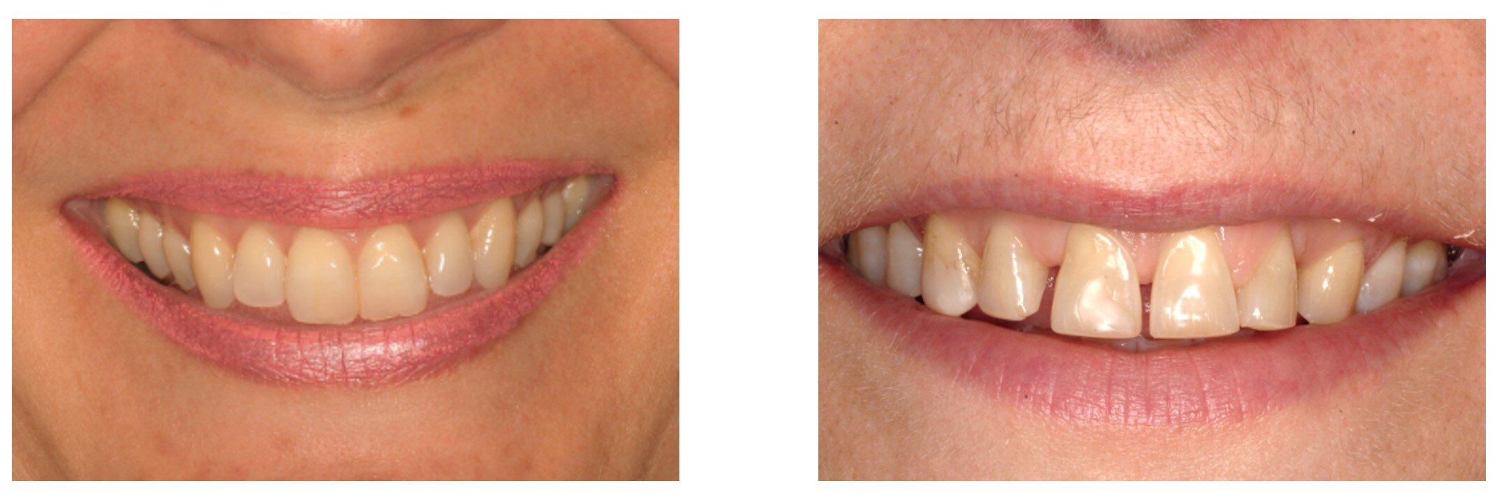 口腔医生审美图鉴:测一测你的前牙有几分?