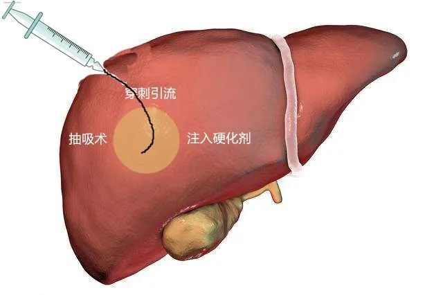 圖文圖片