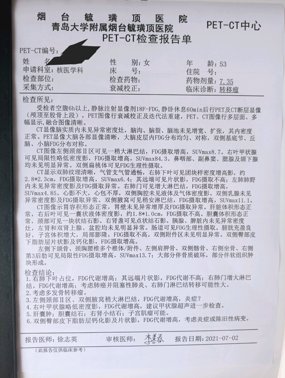 劉懿博士說肺癌二二六八肩膀後背疼一查是晚期肺癌骨轉移