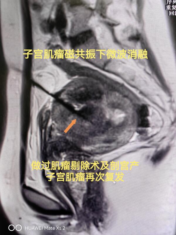 圖文圖片
