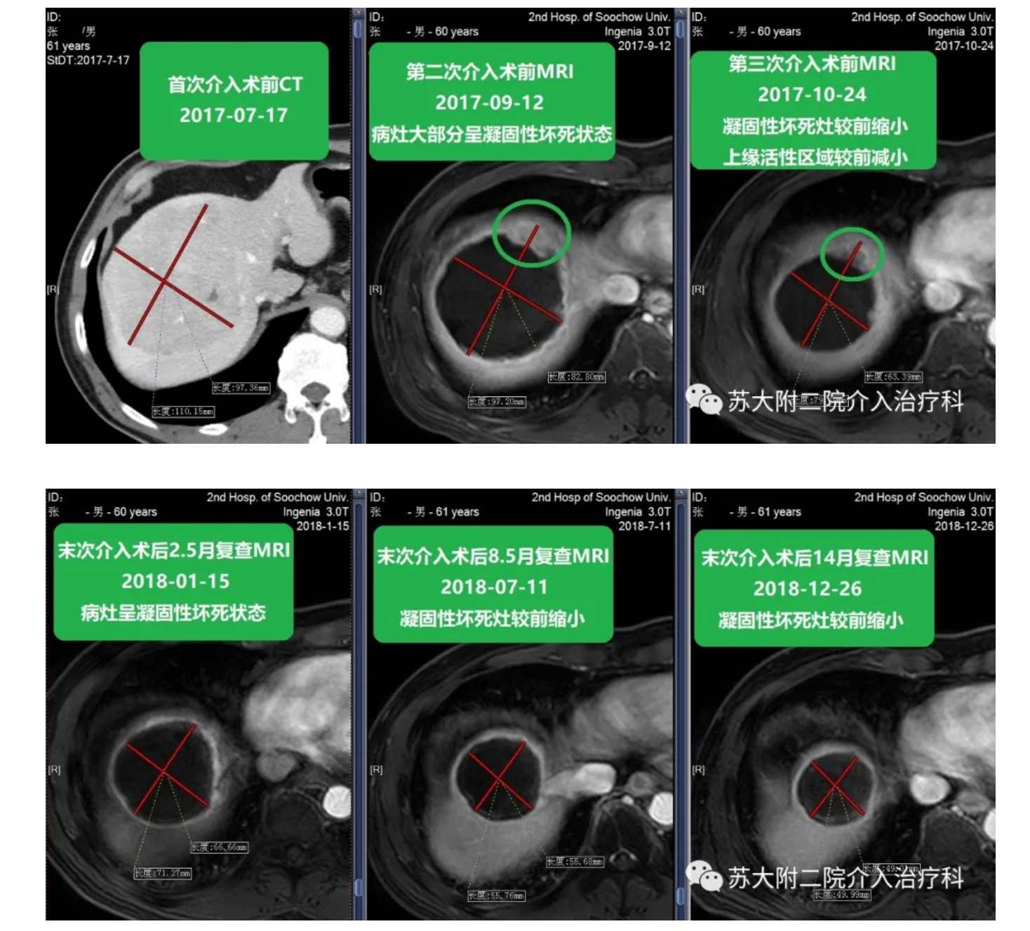 1595412035503080.png image.png