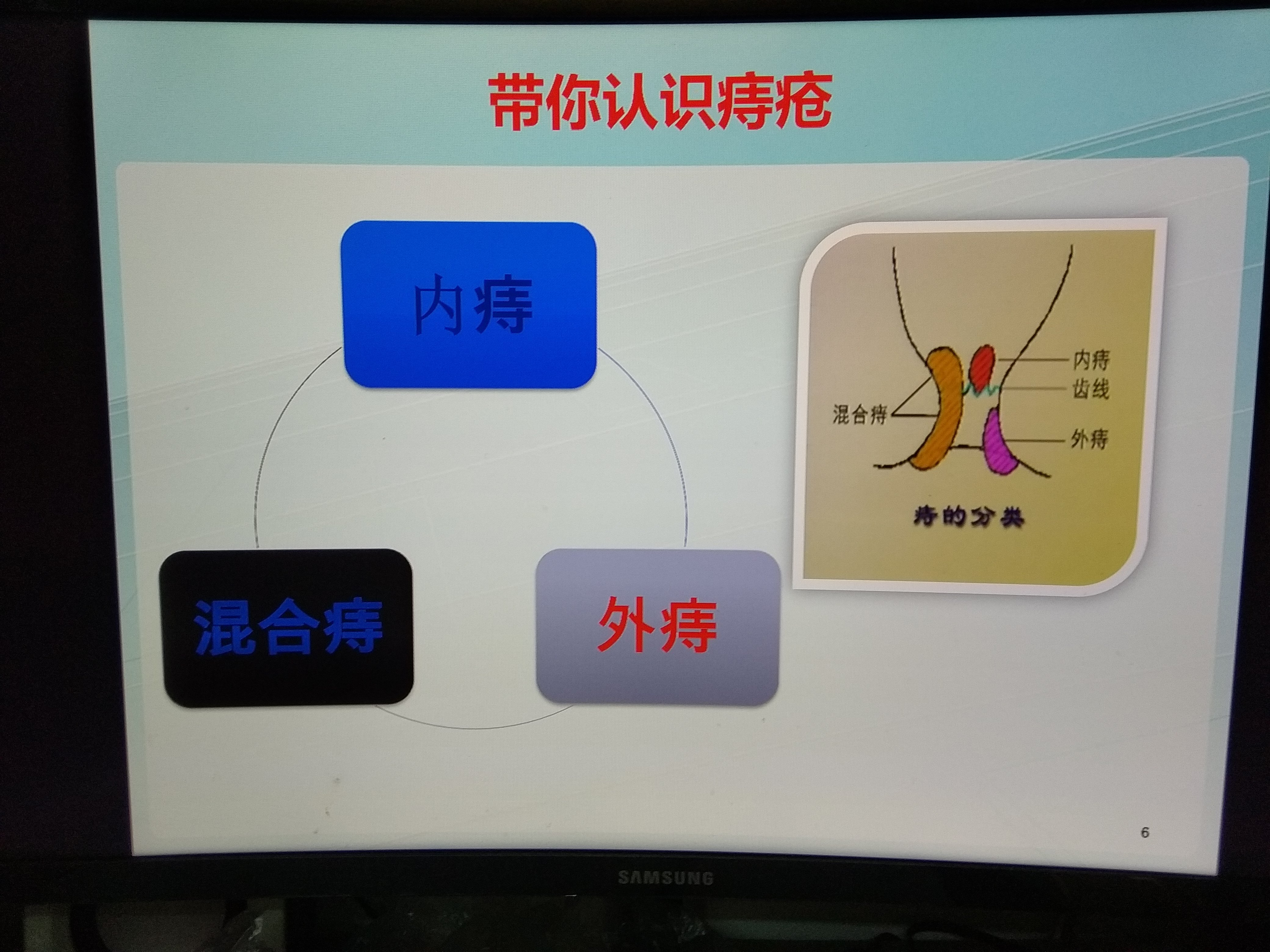 带你认识痔疮_痔疮_介绍_治疗方式 好大夫在线