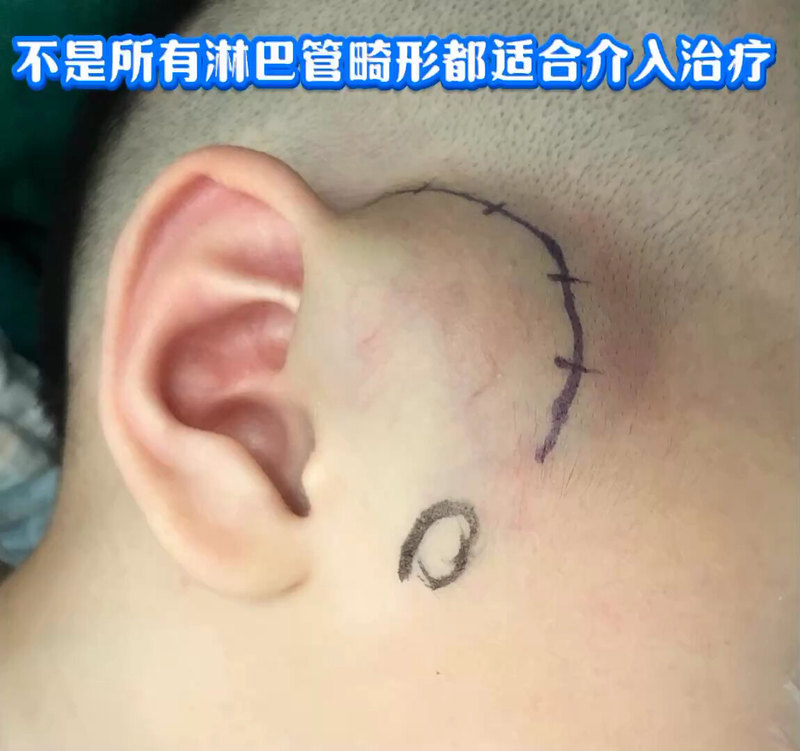 視頻封面
