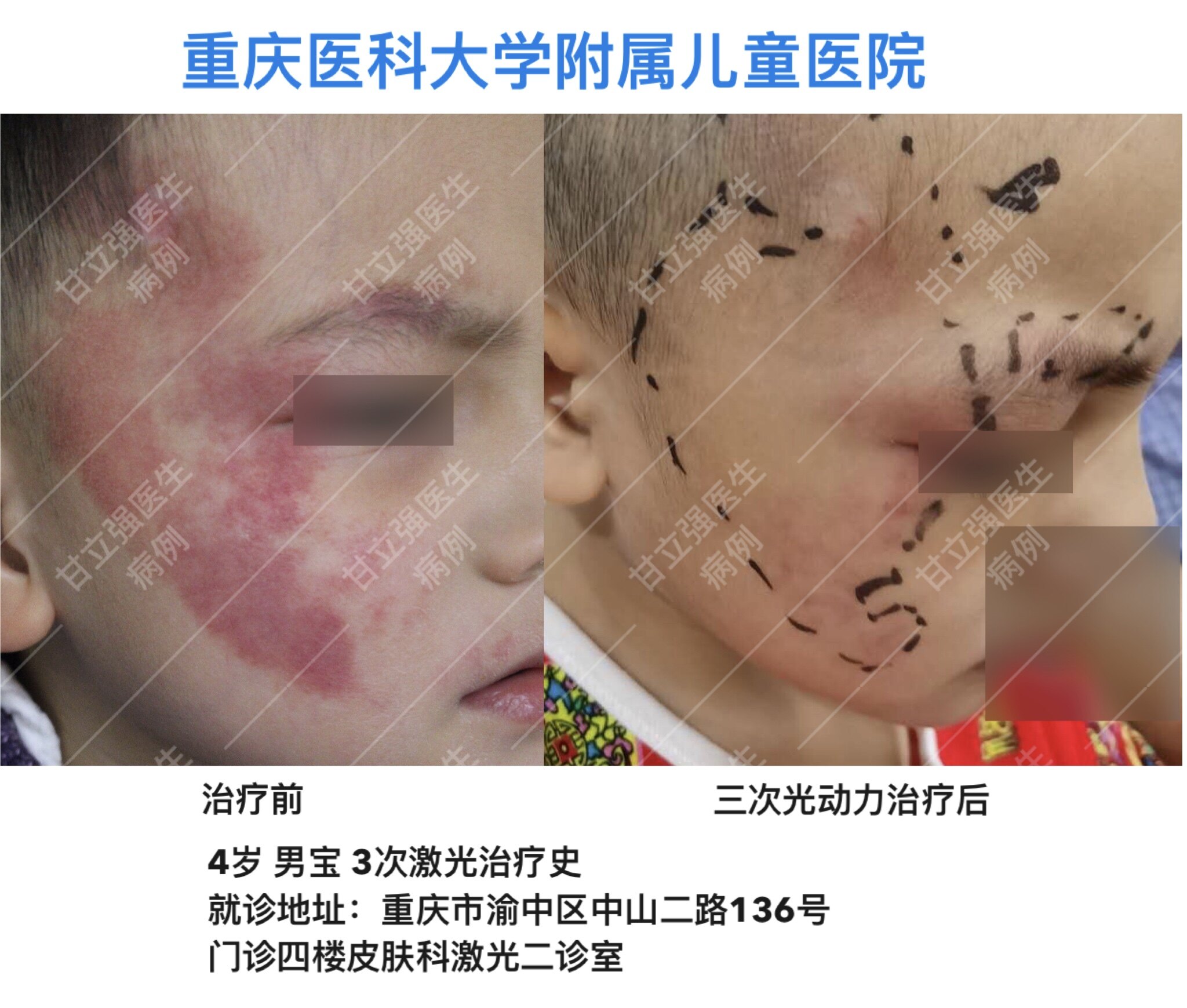 暂无