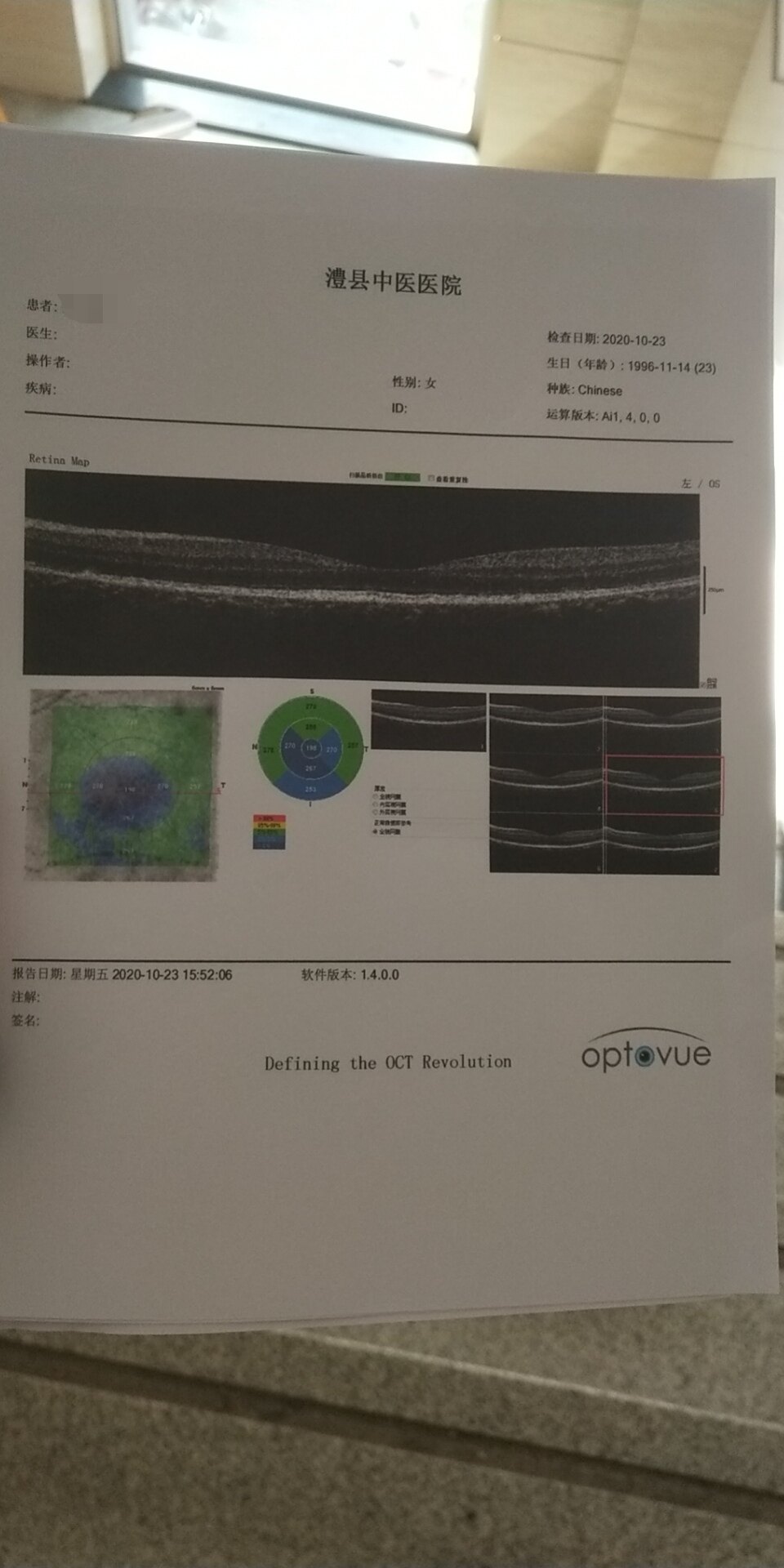 眼科oct报告图图片