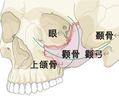 颧骨在哪_颧骨高是指哪里 颧骨在哪_颧骨高是指哪里