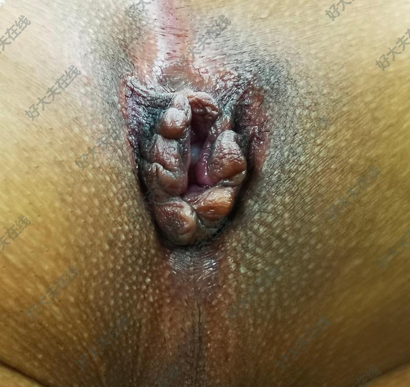 圖文圖片