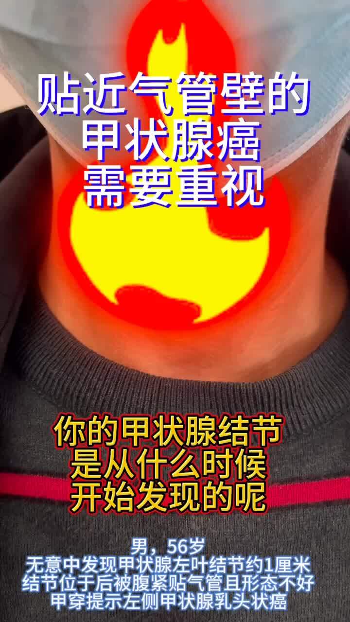 視頻封面