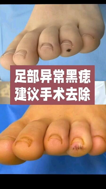 視頻封面