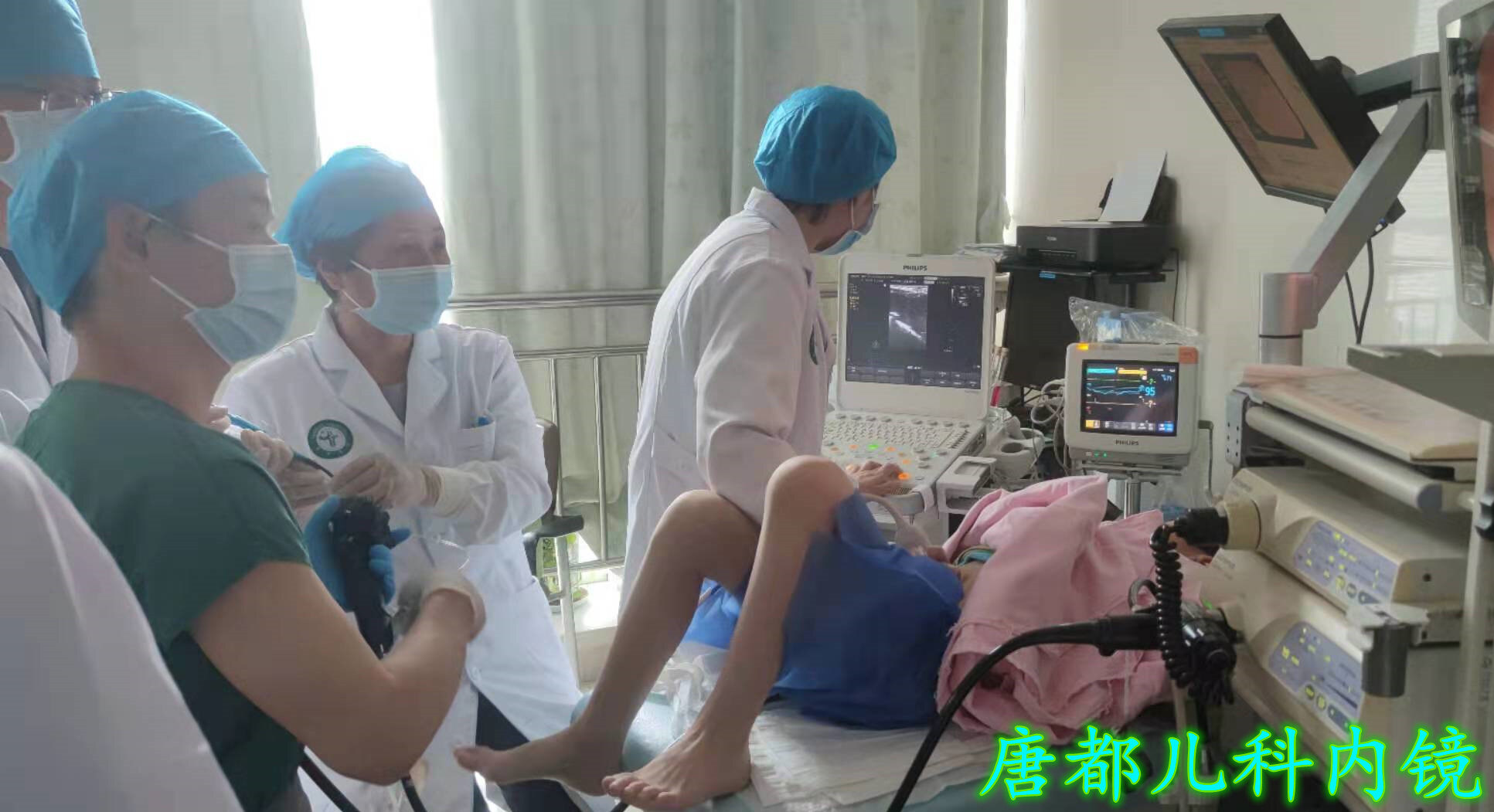 小儿阑尾炎内镜治疗病例20210507