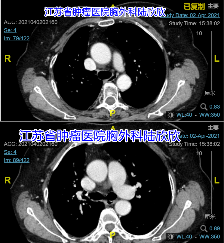 2021-04-02CT两张图水印副本.png